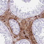 Immunohistochemical staining of human testis shows moderate cytoplasmic positivity in Leydig cells.
