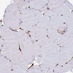 Immunohistochemical staining of human skeletal muscle shows no positivity in myocytes as expected.