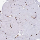 Immunohistochemical staining of human skeletal muscle shows no positivity in myocytes as expected.