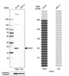 Western blot analysis in human cell lines A-431 and MCF-7 using Anti-CAV2 antibody. Corresponding CAV2 RNA-seq data are presented for the same cell lines. Loading control: Anti-PPIB.