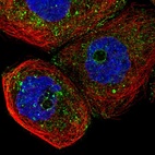 Immunofluorescent staining of human cell line A-431 shows localization to vesicles.