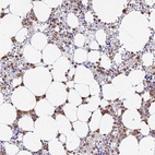 Anti-VWC2L Antibody