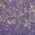 Anti-DNPEP Antibody