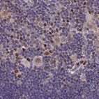 Immunohistochemical staining of human lymph node using Anti-DNPEP antibody HPA044860.