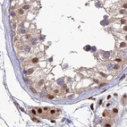 Immunohistochemical staining of human testis using Anti-DNPEP antibody HPA044860.