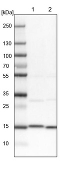 Lane 1: NIH-3T3 cell lysate (Mouse embryonic fibroblast cells)_br/_Lane 2: NBT-II cell lysate (Rat Wistar bladder tumour cells)