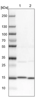 Lane 1: NIH-3T3 cell lysate (Mouse embryonic fibroblast cells)_br/_Lane 2: NBT-II cell lysate (Rat Wistar bladder tumour cells)