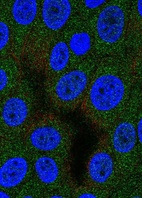 Immunofluorescent staining of human cell line MCF7 shows localization to cytosol.