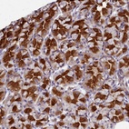 Anti-TTC5 Antibody