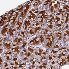 Anti-TTC5 Antibody