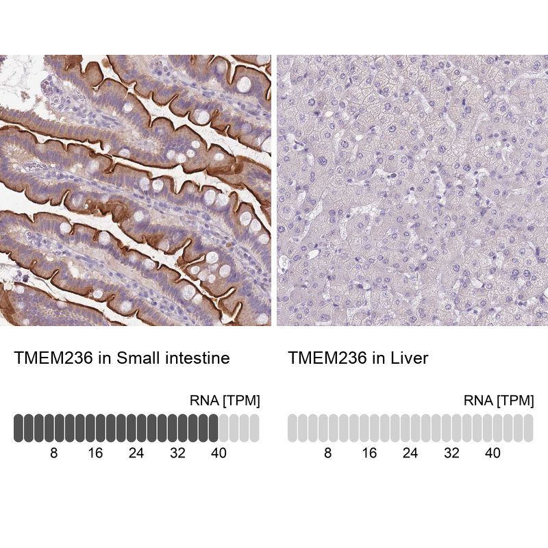 Anti-TMEM236 Antibody