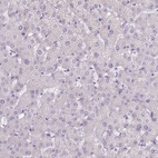 Anti-TMEM236 Antibody