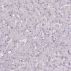 Immunohistochemical staining of human liver shows low expression as expected.