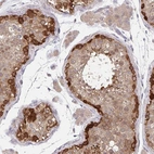 Immunohistochemical staining of human testis shows high expression.
