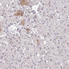 Immunohistochemical staining of human liver shows low expression as expected.