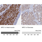 Anti-MPC1 Antibody