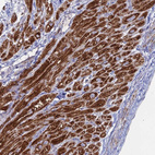 Immunohistochemical staining of human heart muscle shows strong positivity in mitochondria in cardiomyocytes.