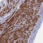 Immunohistochemical staining of human heart muscle shows strong positivity in mitochondria in cardiomyocytes.