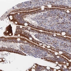 Immunohistochemical staining of human duodenum shows strong positivity in mitochondria in glandular cells.
