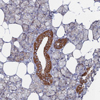 Immunohistochemical staining of human salivary gland shows strong positivity in mitochondria in ductal cells.
