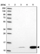 Lane 1: Marker [kDa] 250, 130, 95, 72, 55, 36, 28, 17, 10_br/_Lane 2: Human cell line RT-4_br/_Lane 3: Human cell line U-251MG sp_br/_Lane 4: Human plasma (IgG/HSA depleted)_br/_Lane 5: Human liver tissue