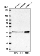 Western blot analysis in U2OS cells transfected with control siRNA, target specific siRNA probe #1 and #2, using Anti-RPP38 antibody. Remaining relative intensity is presented