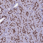 Anti-PARP1 Antibody