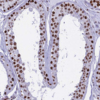 Anti-PARP1 Antibody