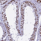 Immunohistochemical staining of human testis shows strong nuclear positivity in cells in seminiferous ducts.