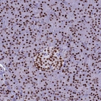 Immunohistochemical staining of human pancreas shows strong nuclear positivity.