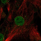 Immunofluorescent staining of human cell line LHCN-M2 shows localization to nucleoplasm, nuclear membrane & vesicles.
