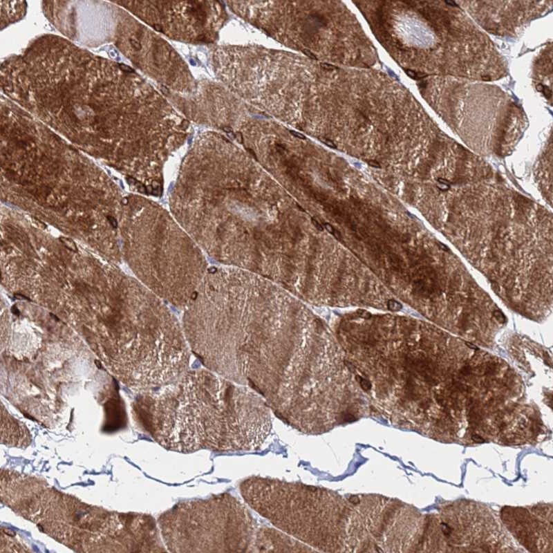 Anti-C5orf34 Antibody