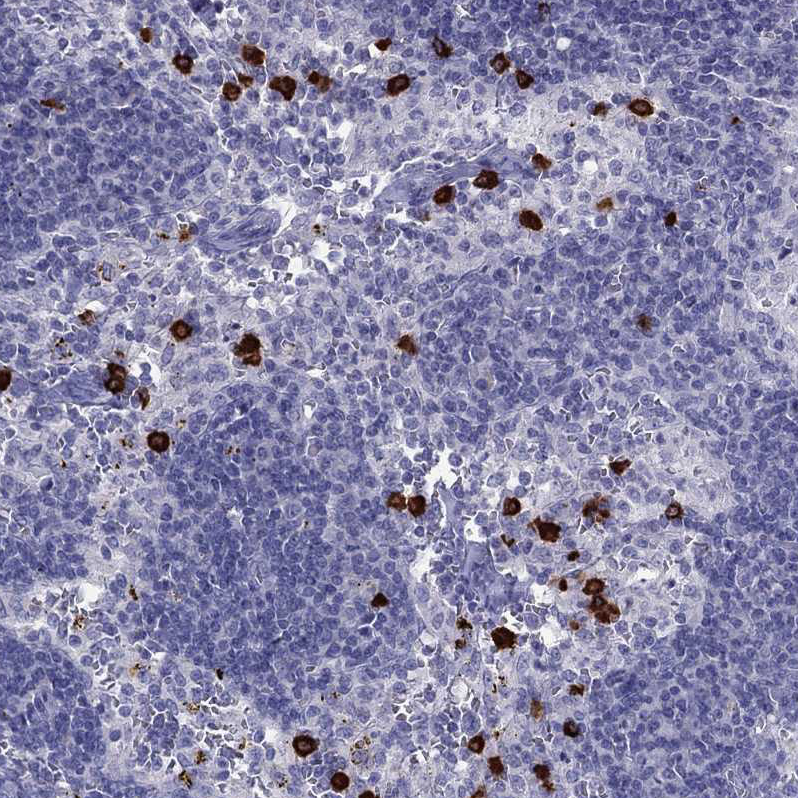 Anti-IL17REL Antibody