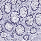 Immunohistochemical staining of human rectum shows negative cytoplasmic positivity in glandular cells as expected.