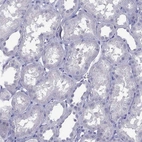 Immunohistochemical staining of human kidney shows negative cytoplasmic positivity in cells in tubules as expected.
