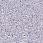 Immunohistochemical staining of human liver shows negative cytoplasmic positivity in hepatocytes as expected.