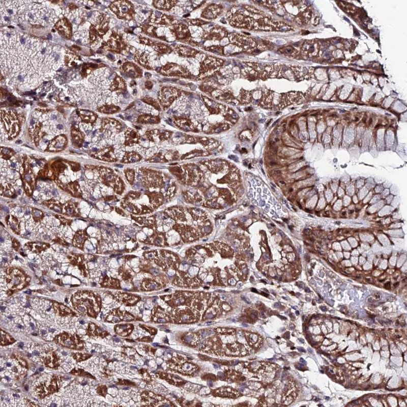Anti-AMER3 Antibody