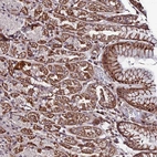 Anti-AMER3 Antibody