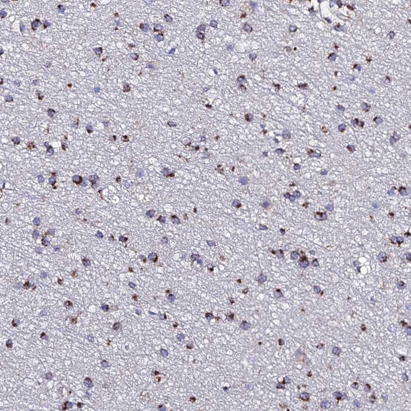 Anti-BORCS8 Antibody