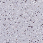 Anti-BORCS8 Antibody