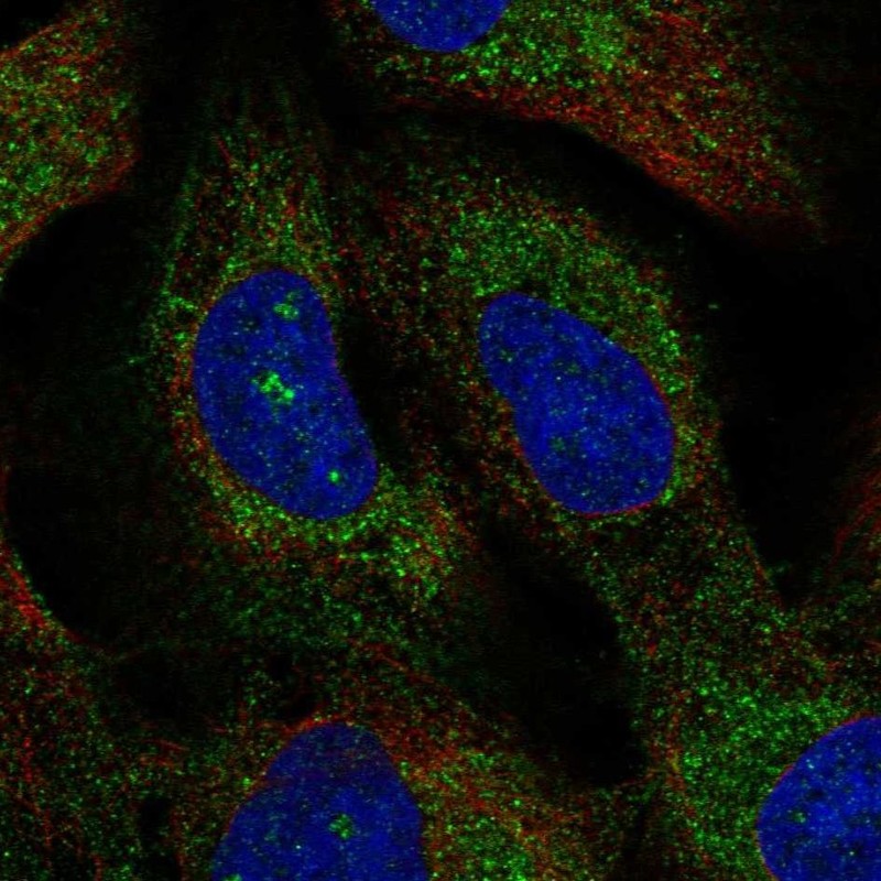 Anti-TMEM212 Antibody