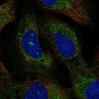 Anti-TMEM212 Antibody