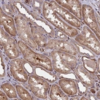 Immunohistochemical staining of human kidney shows moderate cytoplasmic positivity in cells in tubules.