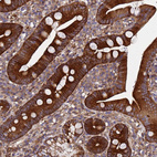 Immunohistochemical staining of human duodenum shows strong cytoplasmic positivity in glandular cells.