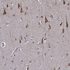 Immunohistochemical staining of human cerebral cortex shows moderate cytoplasmic positivity in neurons.
