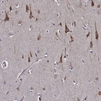 Immunohistochemical staining of human cerebral cortex shows moderate cytoplasmic positivity in neurons.