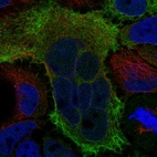 Immunofluorescent staining of human cell line CACO-2 shows localization to plasma membrane.