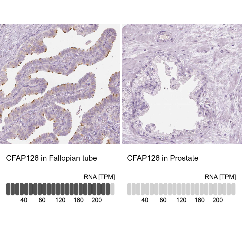 Anti-CFAP126 Antibody