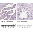 Anti-CFAP126 Antibody