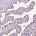 Immunohistochemical staining of human fallopian tube shows high expression.